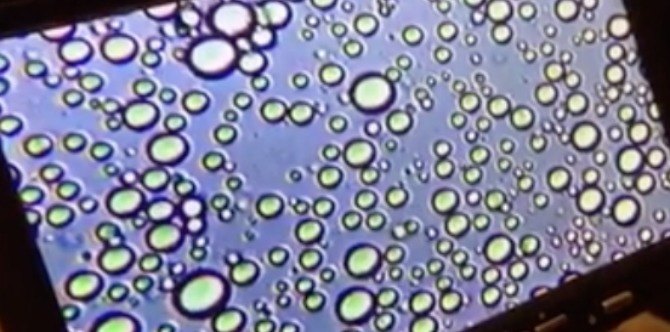 Putting breastmilk under a microscope: An interview with the mum behind it