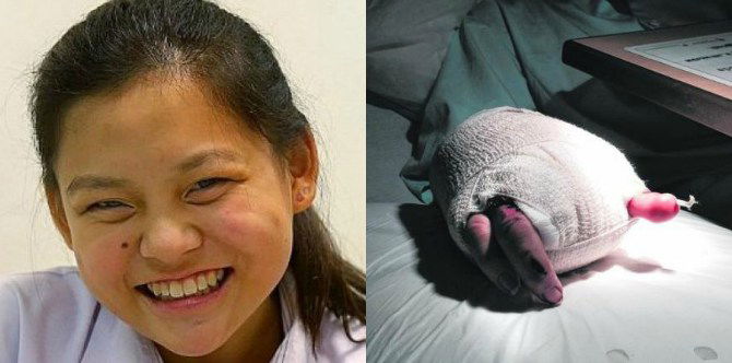 Girl overcomes terrible accident and clears N Levels with great resilience