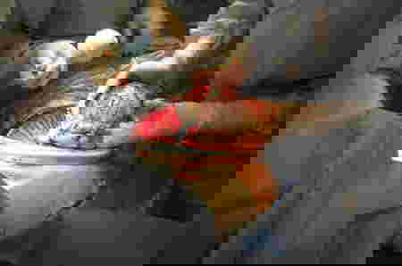 normal for a c-section scar 