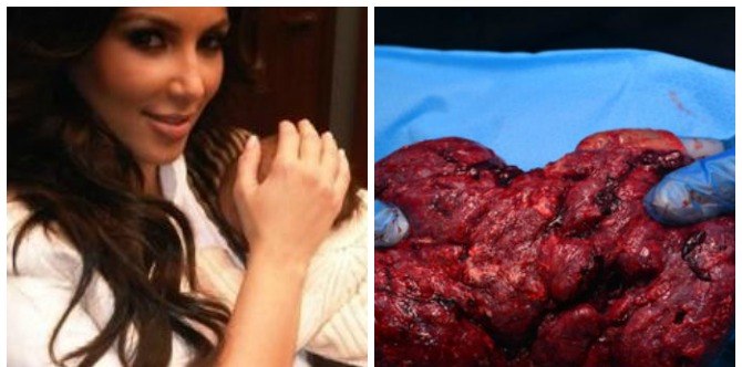 Kim Kardashian wants to eat her own placenta