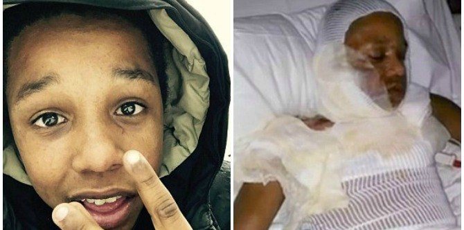 Bully sprays cologne on physically disabled classmate and sets him on fire