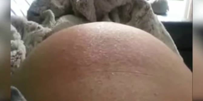 Eye-popping video shows an unborn baby threatening to burst out of her mother’s womb