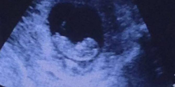 LOOK: The viral ultrasound photo that's set to top the 'Find the Panda' craze