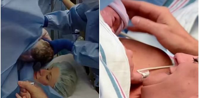 The clever new invention that's giving C-section mums a powerful maternal experience