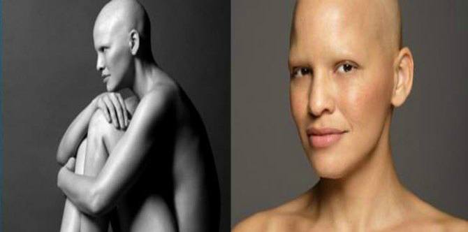 'I have stage 3 breast cancer and I have never felt more beautiful in my entire life'