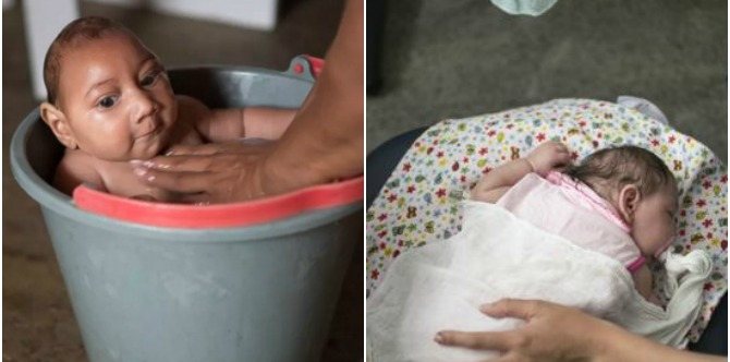 The scary new tropical virus that is shrinking babies' brains