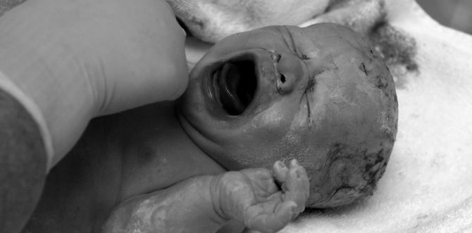 Baby born with brain damage possibly due to Zika virus