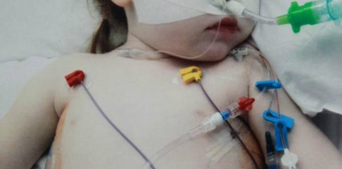 Swallowed Battery Burns Hole Through Toddler’s Lung