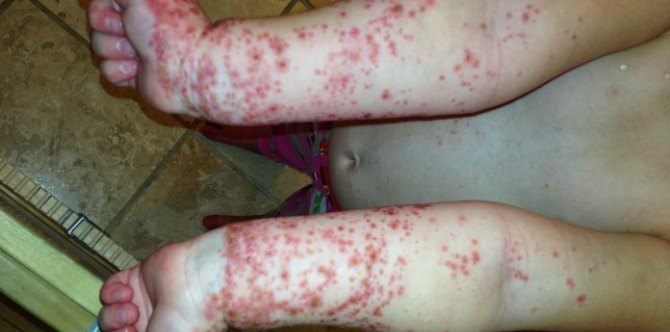 This popular children’s attraction can be dangerous for kids