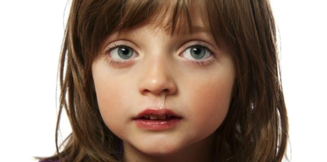 A plea to that parent whose child has a cold: let him recover first