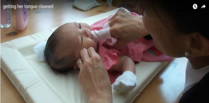Watch: Easy Tips To Clean Your Infant's Tongue at Home
