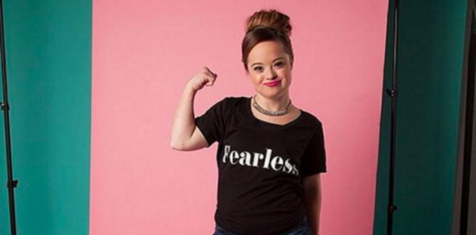 Model with down syndrome becomes a beauty ambassador
