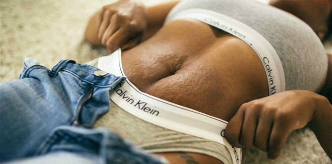 Mum celebrates her stretch marks by recreating famous underwear ad