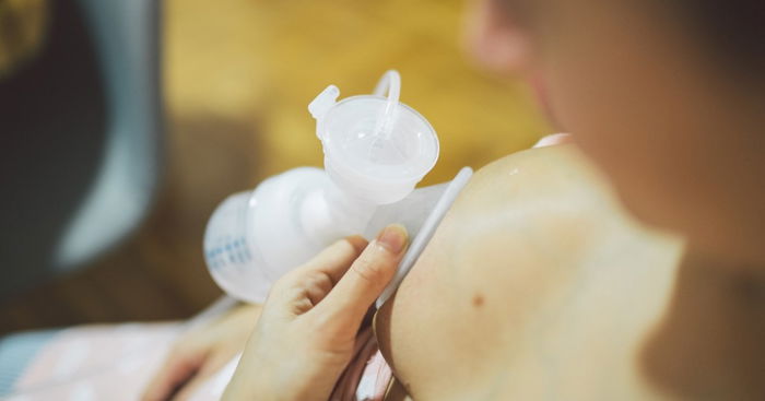 Unpumped Breast Milk Can Lead to a Serious Blood Infection Sepsis