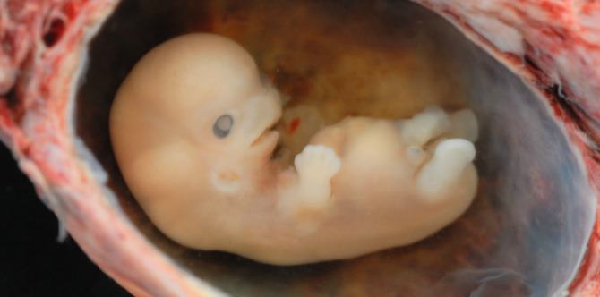 Dealing with anxiety and struggles that comes after a miscarriage