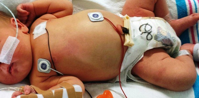 Mum pens heartbreaking post about newborn’s death caused by Cronobacter Infection