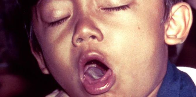7 Types of Cough in Your Child That You Need to Pay Attention to