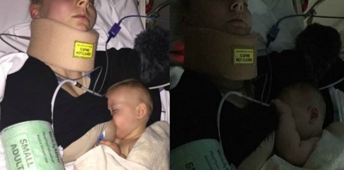 Photo of battered mom breastfeeding goes viral for all the right reasons