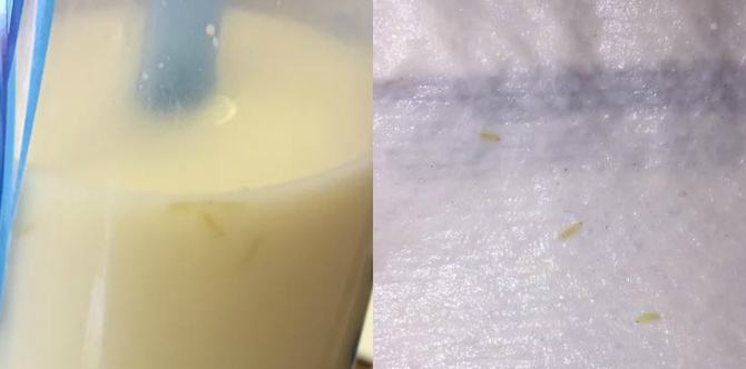 Horrified mother finds maggots in her baby's formula