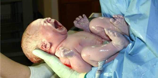 My birth story: An unexpected delivery