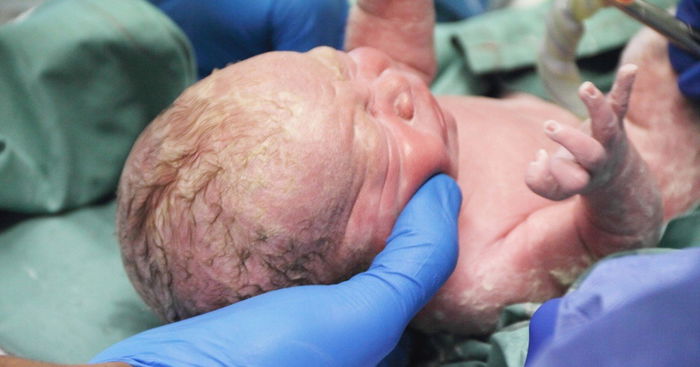 Planning an Early Birth Might Cause Developmental Problems for Your Baby