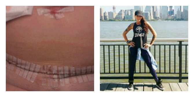 Inspiring! Cancer Survivor Mum Becomes World Famous Zumba Instructor!