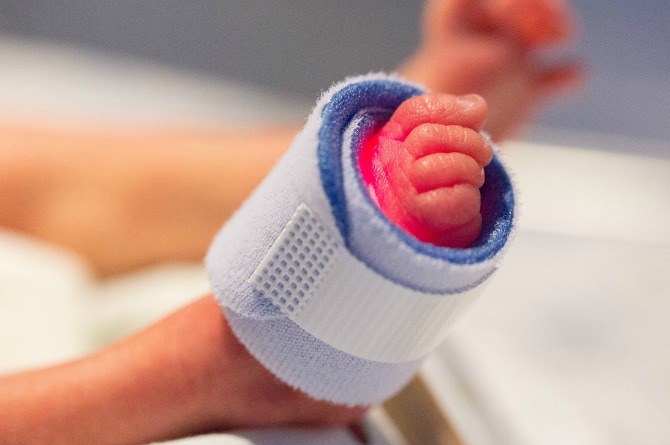 Baby born with two types of cancers inspires other patients to go on!