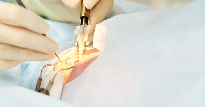 Shocking! LASIK Patients Suffer From More Eye Problems After Treatment