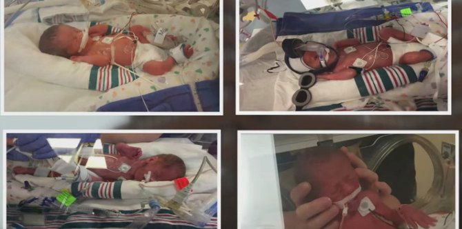 Miraculous! Mum diagnosed with cancer gives birth to quadruplets