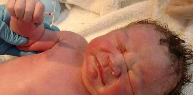Can a baby really be born clutching an IUD... like this?