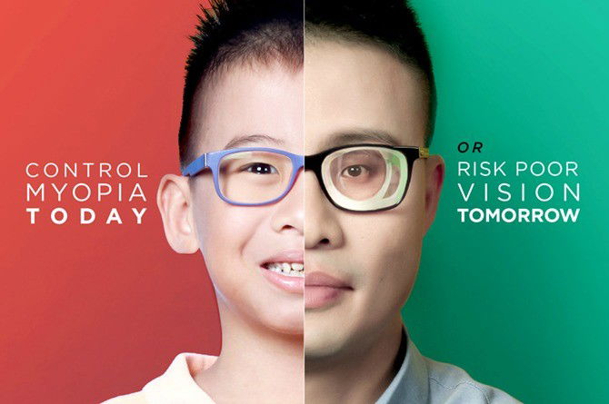 How to control myopia in your child when there’s only a narrow window of opportunity