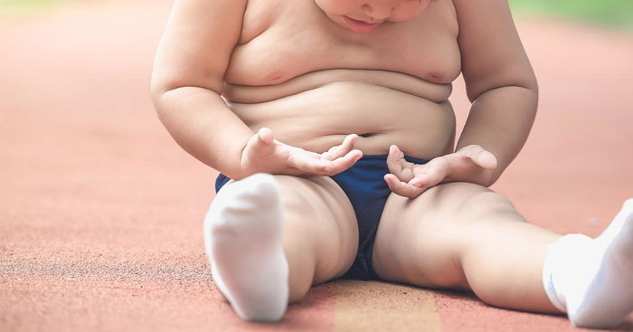 Chubby Kids Likely To Become Overweight Adults, Warns Experts