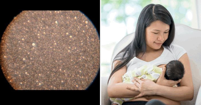 The Difference Between Breastmilk, Cow's Milk And Formula Under The Microscope