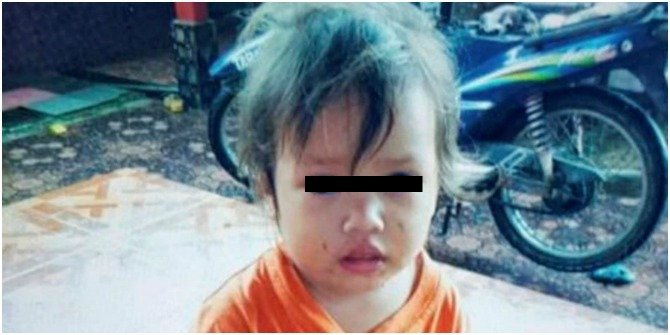 2-year-old girl dies after being stung by hornets
