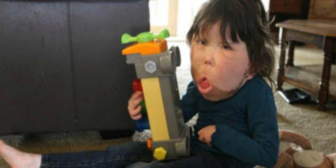 The story of Katie, a strong little girl battling a condition so rare, it doesn’t even have a name
