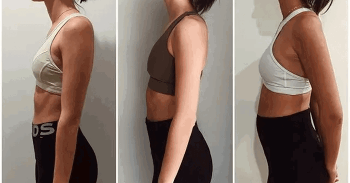 Retroverted Uterus: The REAL Reason Why This Pregnant Mum's 6-month Baby Bump is Smaller Than Normal!