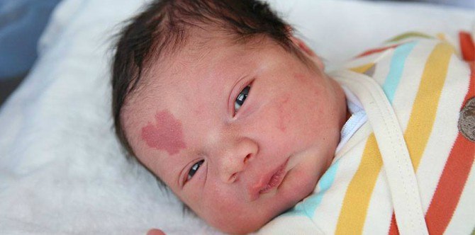 This Cute Little Baby Has the Most Amazing Birthmark!