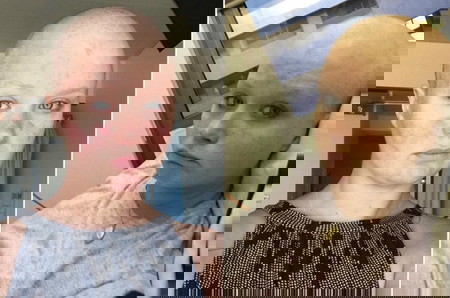 Molar Pregnancy: This Mom Gave Birth To A Tumor Instead Of A Baby