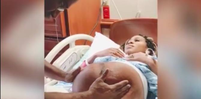 WATCH: Doctor Turns a Breech Baby While in the Womb!