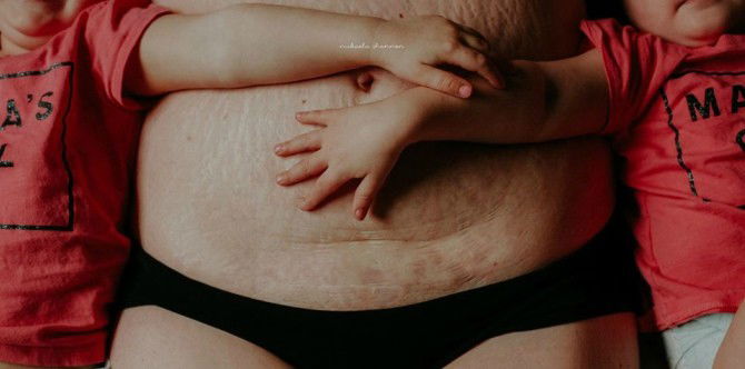 LOOK: This mum blogger proudly shares her unflitered postpartum body!