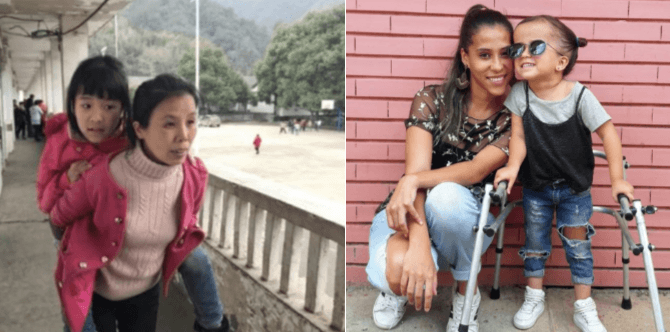 Devoted Mum Carries Daughter With Cerebral Palsy Everywhere