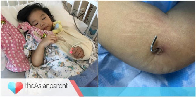 Singapore Mum Warns Of Bouncy Castle Dangers After Toddler Fractures Her Arm
