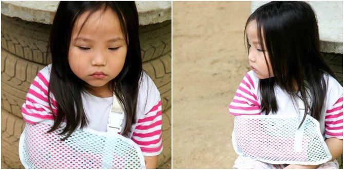 Nursemaid Elbow Injury in Children: Must-know Information for All Parents