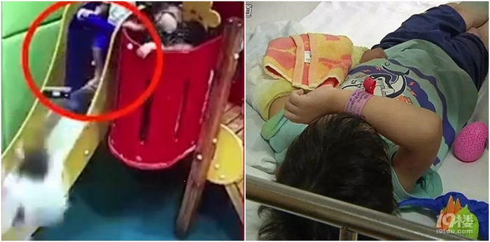5-year-old boy fractures arm after getting kicked off slide by another child