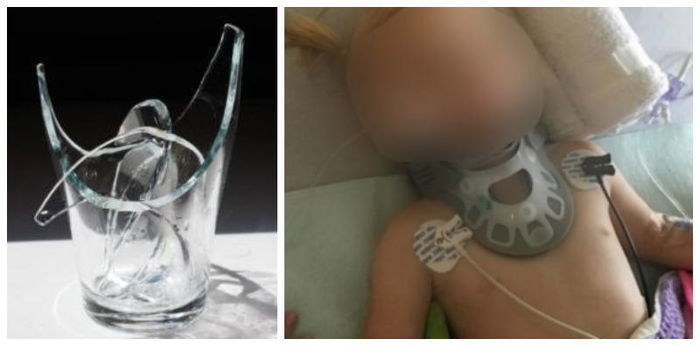 Toddler Stabbed in Spine in Freak Accident, Leaving Her Partially Paralysed