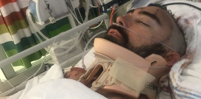 Dad fighting for life after breaking son's fall over balcony: Is your home truly safe?