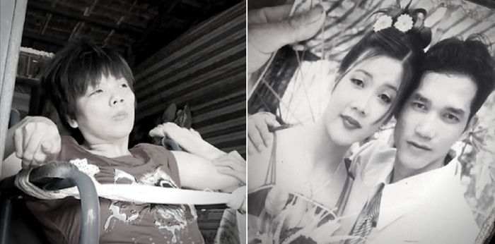 Woman Left Paralysed After Giving Birth Due To Metrorrhagia: Have You Heard Of This Condition?