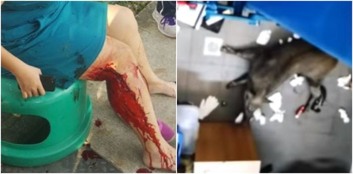 Pregnant Mum Left Injured And Bleeding After Wild Boar Attack in Singapore