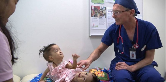 successful separation of conjoined twins