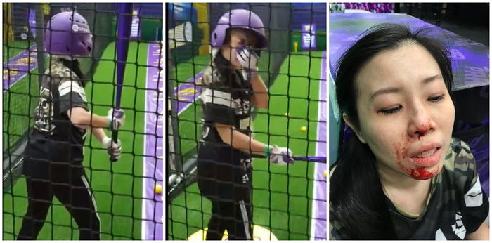 Woman warns parents after nose fracture at indoor activity park in Singapore